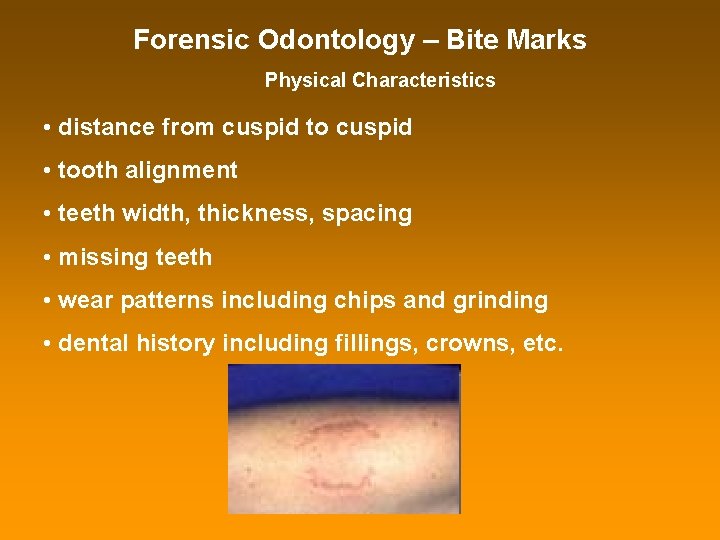 Forensic Odontology – Bite Marks Physical Characteristics • distance from cuspid to cuspid •