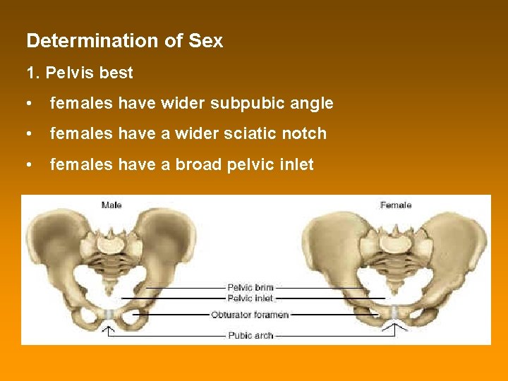 Determination of Sex 1. Pelvis best • females have wider subpubic angle • females