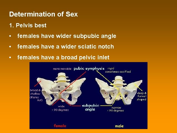 Determination of Sex 1. Pelvis best • females have wider subpubic angle • females