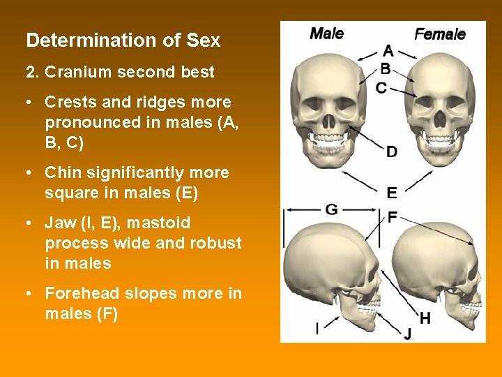 Determination of Sex 2. Cranium second best • Crests and ridges more pronounced in