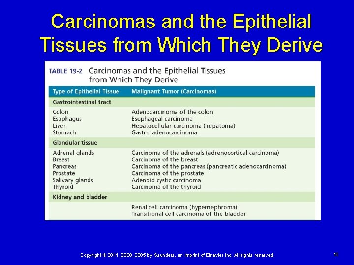 Carcinomas and the Epithelial Tissues from Which They Derive Copyright © 2011, 2008, 2005