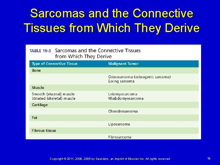 Sarcomas and the Connective Tissues from Which They Derive Copyright © 2011, 2008, 2005