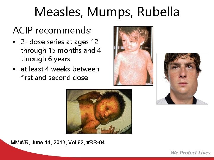 Measles, Mumps, Rubella ACIP recommends: • 2 - dose series at ages 12 through