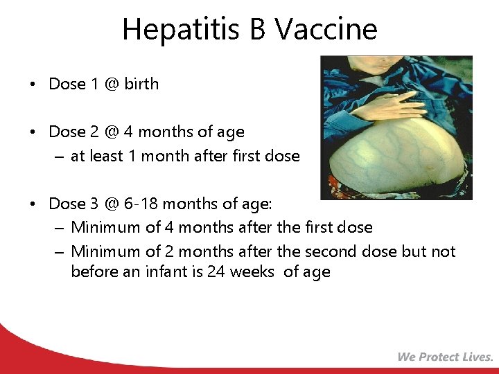 Hepatitis B Vaccine • Dose 1 @ birth • Dose 2 @ 4 months