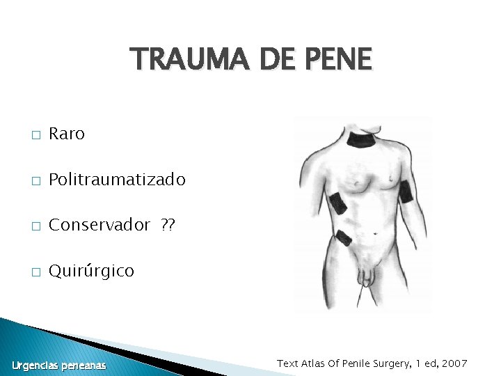 TRAUMA DE PENE � Raro � Politraumatizado � Conservador ? ? � Quirúrgico Urgencias TRAUMA DE PENE � Raro � Politraumatizado � Conservador ? ? � Quirúrgico Urgencias