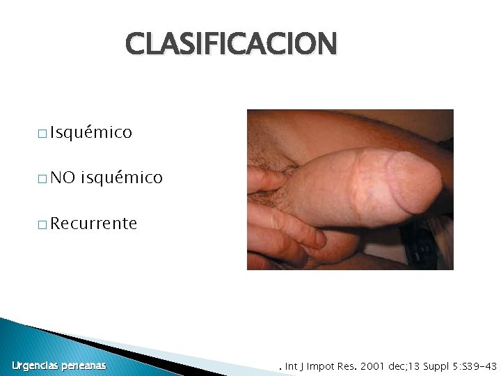 CLASIFICACION � Isquémico � NO isquémico � Recurrente Urgencias peneanas . Int J Impot CLASIFICACION � Isquémico � NO isquémico � Recurrente Urgencias peneanas . Int J Impot