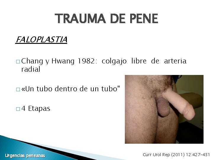 TRAUMA DE PENE FALOPLASTIA � Chang radial � «Un � 4 y Hwang 1982: TRAUMA DE PENE FALOPLASTIA � Chang radial � «Un � 4 y Hwang 1982: