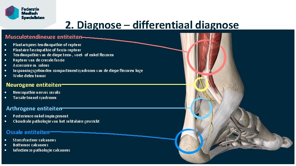 2. Diagnose – differentiaal diagnose Musculotendineuze entiteiten Plantarispees tendinopathie of ruptuur Plantaire fasciopathie of