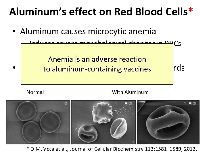 Aluminum’s effect on Red Blood Cells* • Aluminum causes microcytic anemia – Induces severe
