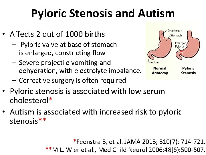 Pyloric Stenosis and Autism • Affects 2 out of 1000 births – Pyloric valve
