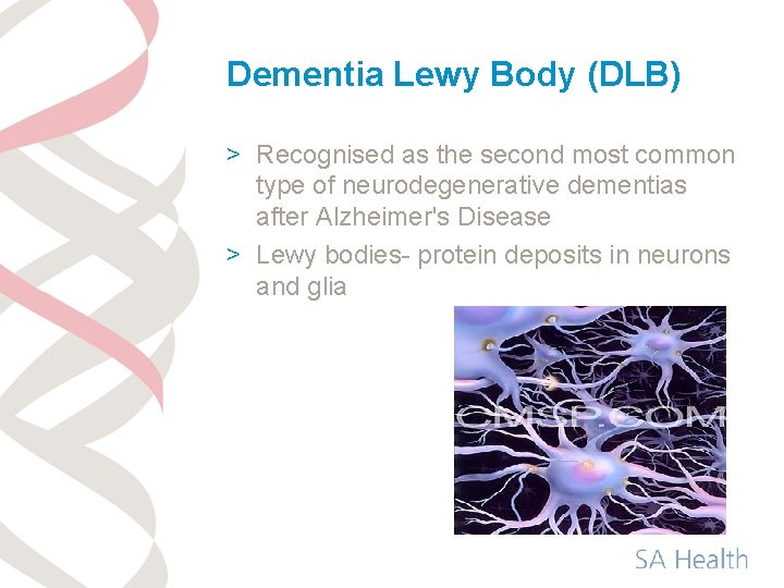 Dementia Lewy Body (DLB) > Recognised as the second most common type of neurodegenerative
