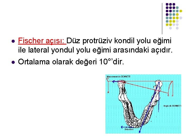 l Fischer açısı: Düz protrüziv kondil yolu eğimi ile lateral yondul yolu eğimi arasındaki