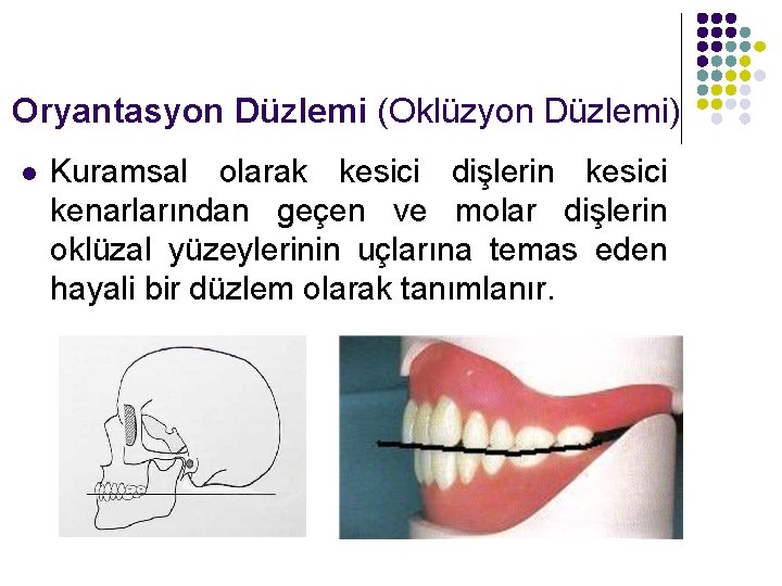 Oryantasyon Düzlemi (Oklüzyon Düzlemi) l Kuramsal olarak kesici dişlerin kesici kenarlarından geçen ve molar