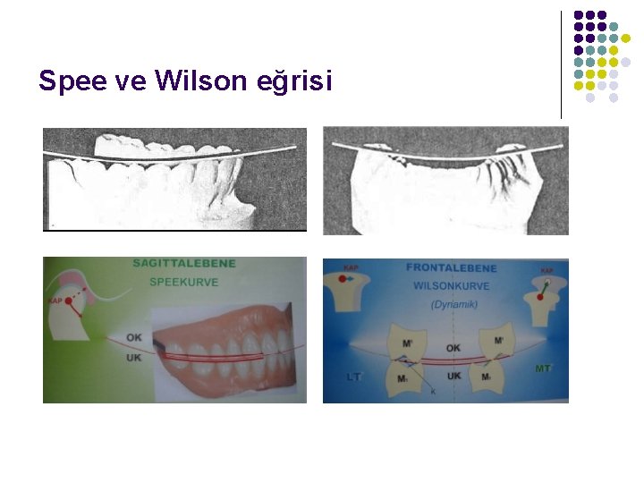 Spee ve Wilson eğrisi 