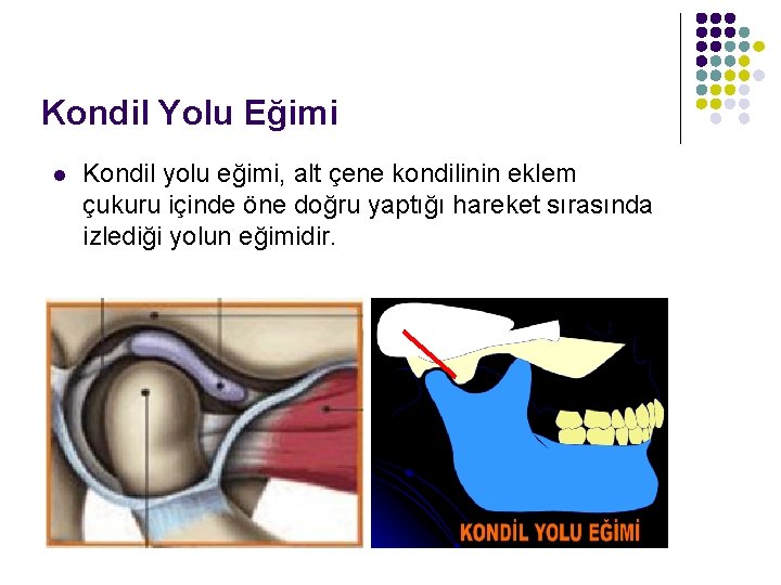 Kondil Yolu Eğimi l Kondil yolu eğimi, alt çene kondilinin eklem çukuru içinde öne