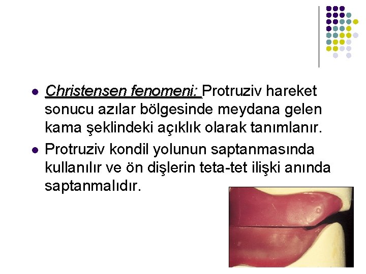 l l Christensen fenomeni: Protruziv hareket sonucu azılar bölgesinde meydana gelen kama şeklindeki açıklık