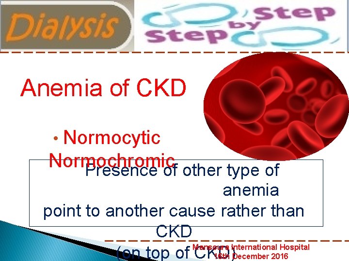 Anemia of CKD • Normocytic Normochromic Presence of other type of anemia point to