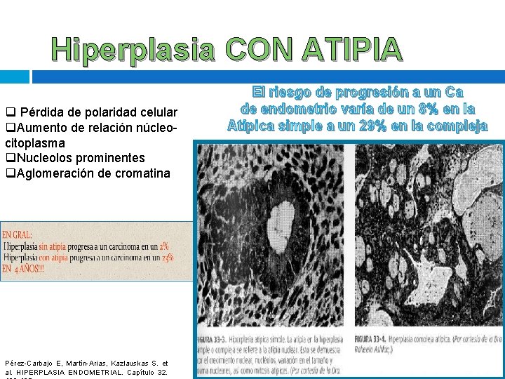 Hiperplasia CON ATIPIA q Pérdida de polaridad celular q. Aumento de relación núcleocitoplasma q. Hiperplasia CON ATIPIA q Pérdida de polaridad celular q. Aumento de relación núcleocitoplasma q.