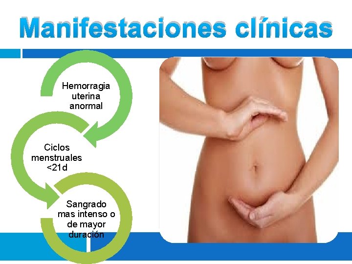 Manifestaciones clínicas Hemorragia uterina anormal Ciclos menstruales <21 d Sangrado mas intenso o de Manifestaciones clínicas Hemorragia uterina anormal Ciclos menstruales <21 d Sangrado mas intenso o de