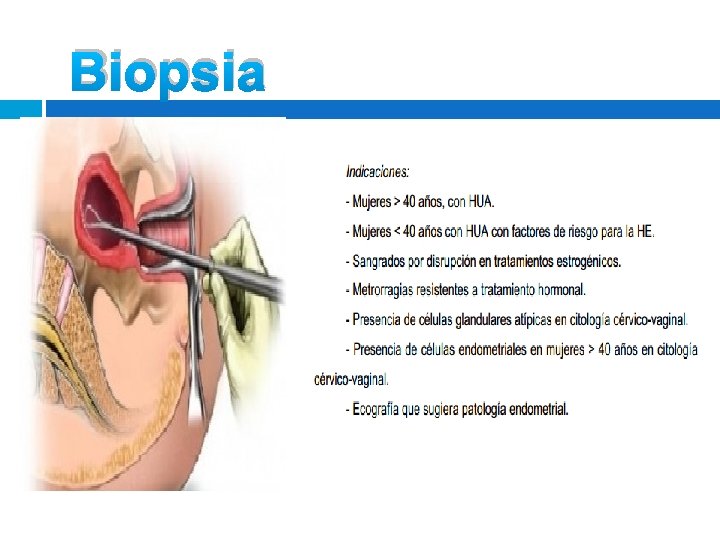 Biopsia Biopsia