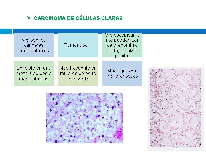 Ø CARCINOMA DE CÉLULAS CLARAS < 5%de los canceres endometriales Tumor tipo II Microscopicame Ø CARCINOMA DE CÉLULAS CLARAS < 5%de los canceres endometriales Tumor tipo II Microscopicame