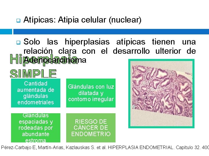 q Atípicas: Atipia celular (nuclear) Solo las hiperplasias atípicas tienen una relación clara con q Atípicas: Atipia celular (nuclear) Solo las hiperplasias atípicas tienen una relación clara con