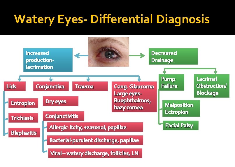 Watery Eyes- Differential Diagnosis Increased productionlacrimation Lids Conjunctiva Decreased Drainage Trauma Entropion Dry eyes