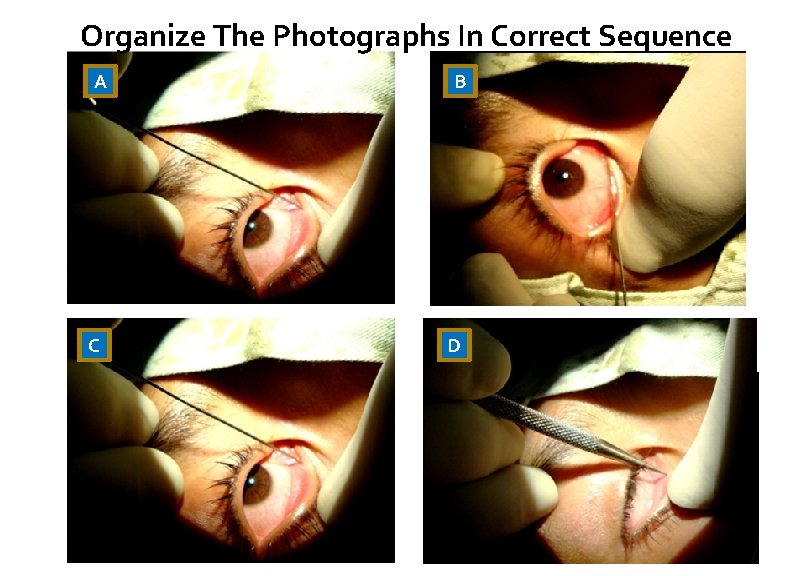 Organize The Photographs In Correct Sequence A C B D 