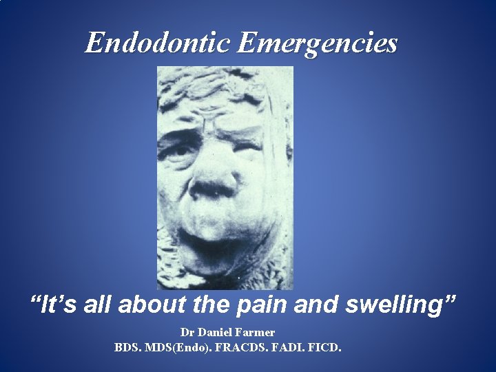 Endodontic Emergencies “It’s all about the pain and swelling” Dr Daniel Farmer BDS. MDS(Endo).