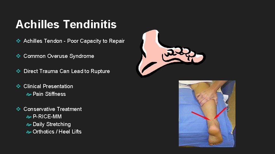 Achilles Tendinitis v Achilles Tendon - Poor Capacity to Repair v Common Overuse Syndrome