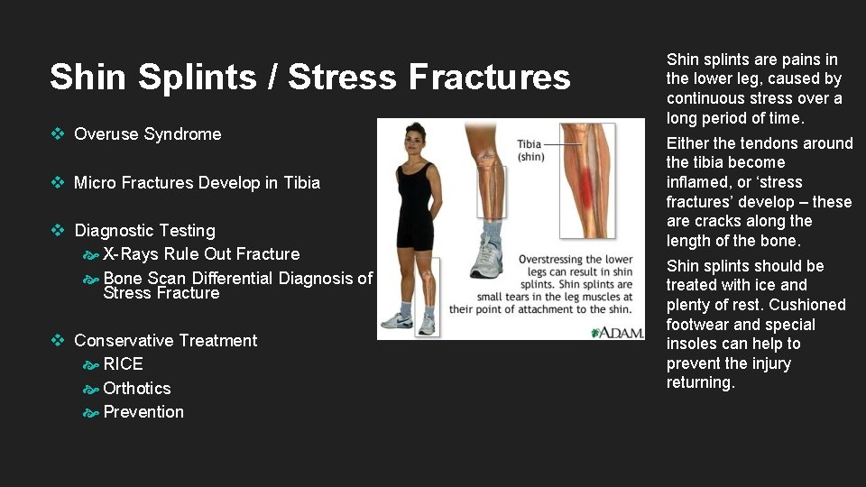 Shin Splints / Stress Fractures v Overuse Syndrome v Micro Fractures Develop in Tibia