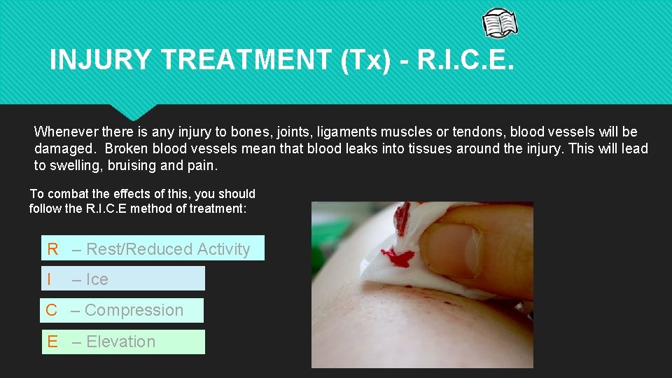 INJURY TREATMENT (Tx) - R. I. C. E. Whenever there is any injury to