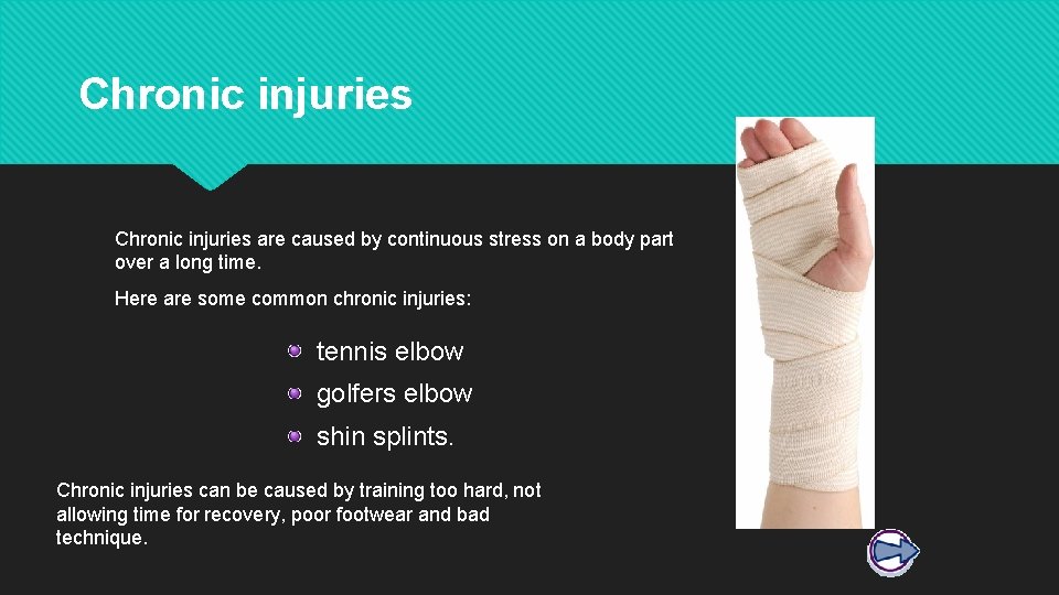 Chronic injuries are caused by continuous stress on a body part over a long