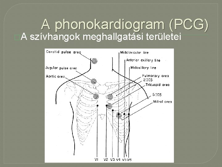 �A A phonokardiogram (PCG) szívhangok meghallgatási területei 