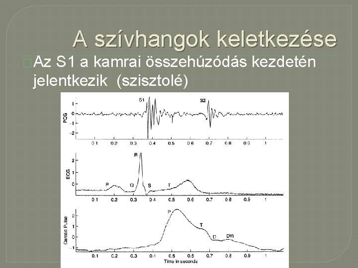 A szívhangok keletkezése �Az S 1 a kamrai összehúzódás kezdetén jelentkezik (szisztolé) 
