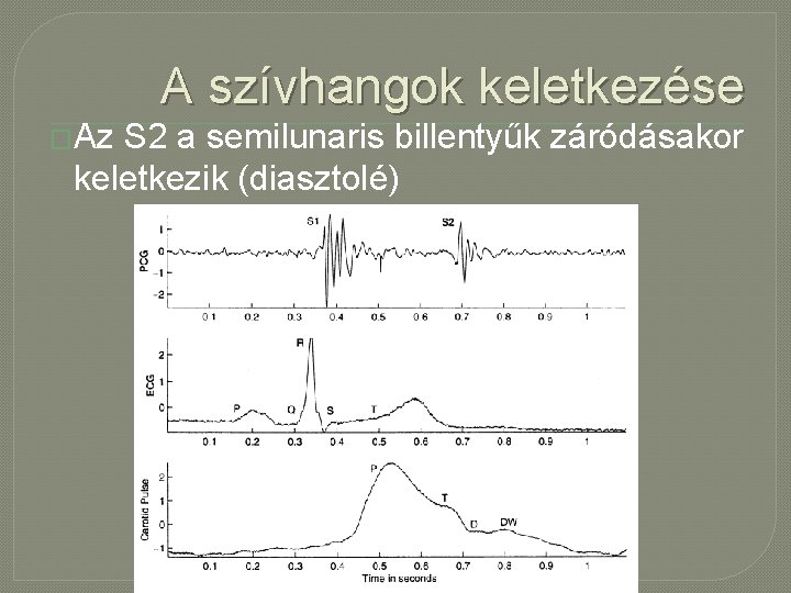 A szívhangok keletkezése �Az S 2 a semilunaris billentyűk záródásakor keletkezik (diasztolé) 