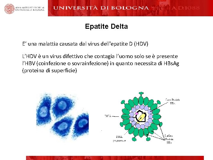 Epatite Delta E’ una malattia causata dal virus dell'epatite D (HDV) L’HDV è un