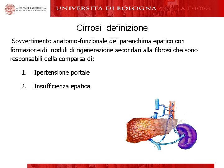 Cirrosi: definizione Sovvertimento anatomo-funzionale del parenchima epatico con formazione di noduli di rigenerazione secondari