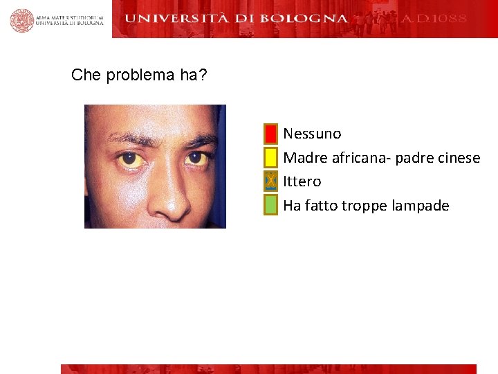 Che problema ha? Nessuno Madre africana- padre cinese Ittero Ha fatto troppe lampade 