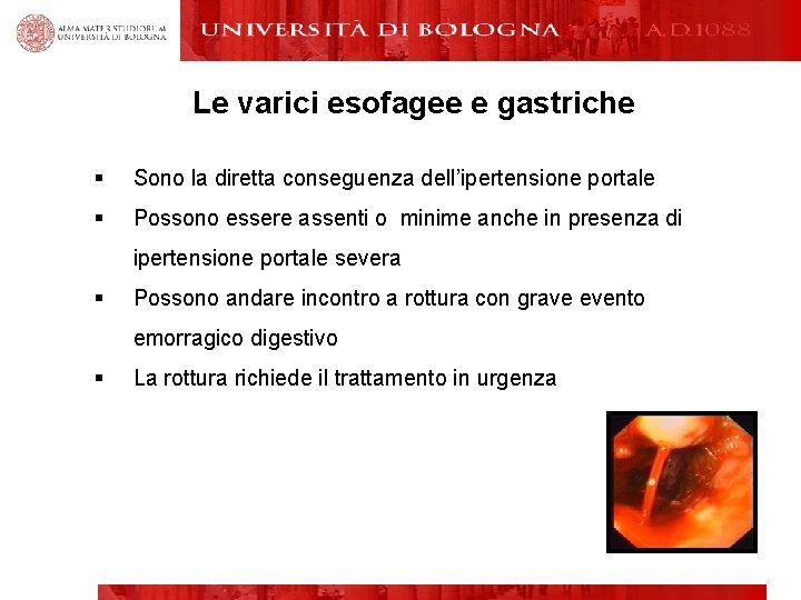 Le varici esofagee e gastriche § Sono la diretta conseguenza dell’ipertensione portale § Possono