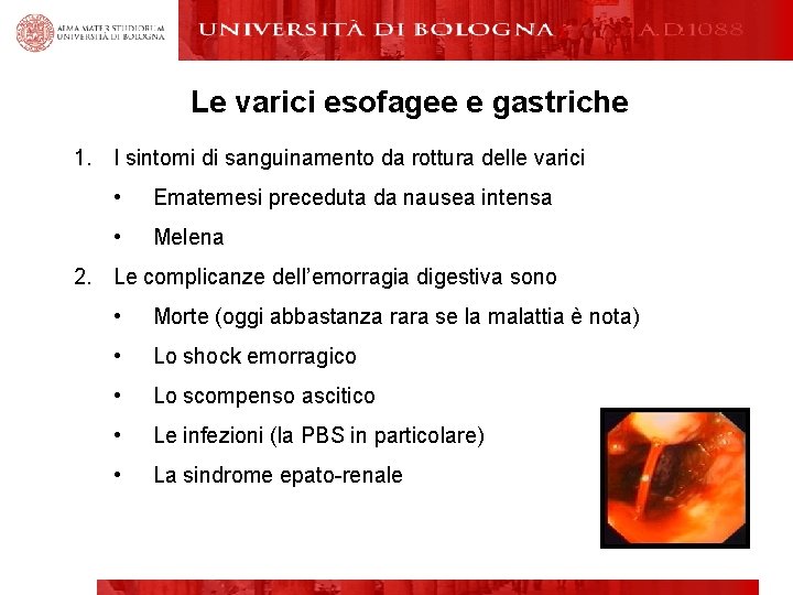 Le varici esofagee e gastriche 1. I sintomi di sanguinamento da rottura delle varici
