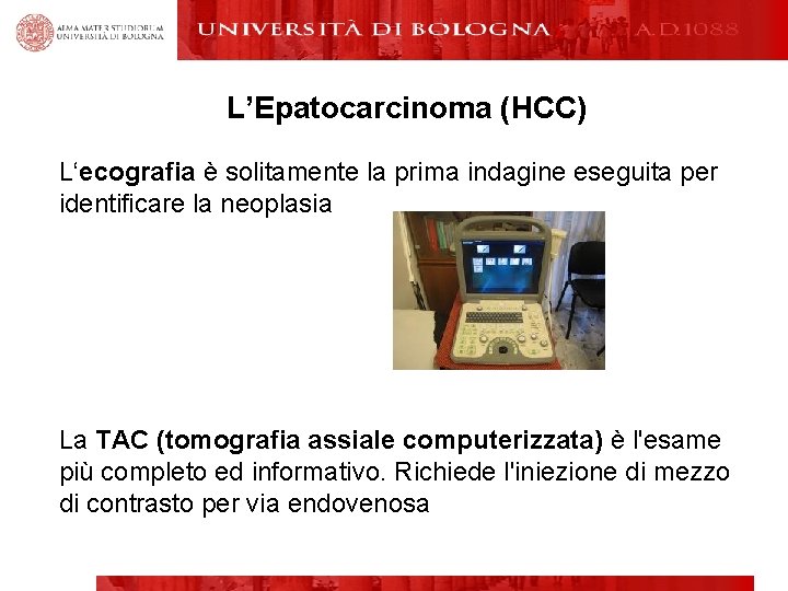 L’Epatocarcinoma (HCC) L‘ecografia è solitamente la prima indagine eseguita per identificare la neoplasia La