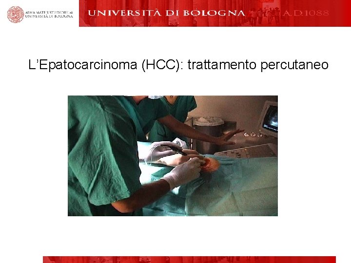 L’Epatocarcinoma (HCC): trattamento percutaneo 