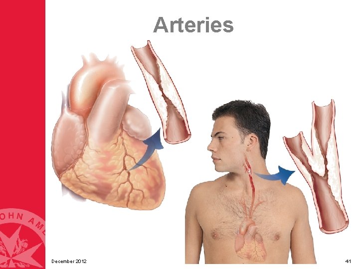 Arteries December 2012 41 Arteries December 2012 41