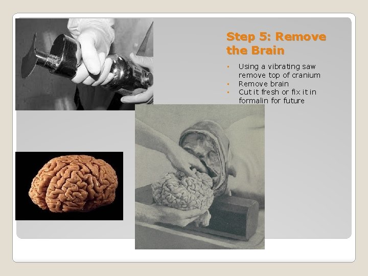 Step 5: Remove the Brain • • • Using a vibrating saw remove top