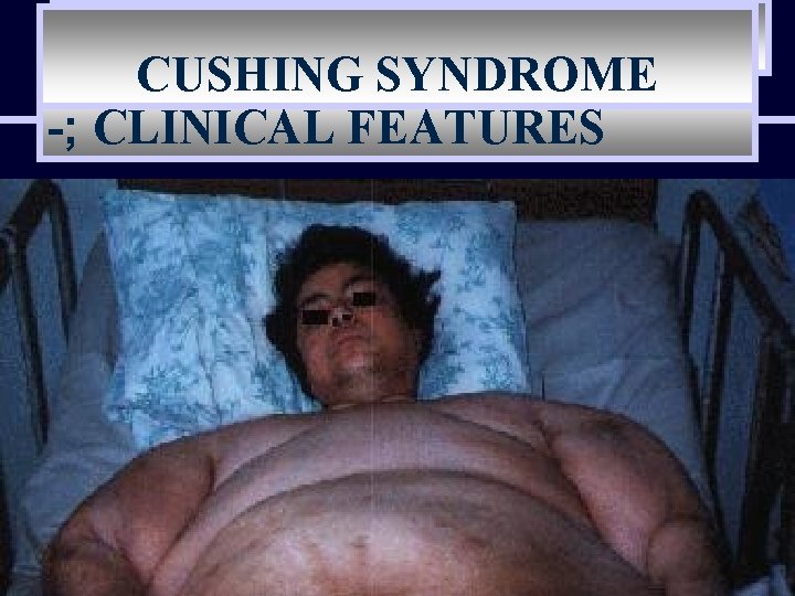 CUSHING SYNDROME -; CLINICAL FEATURES 