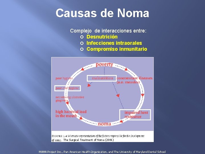 Causas de Noma Complejo de interacciones entre: Desnutrición Infecciones intraorales Compromiso inmunitario The Surgical