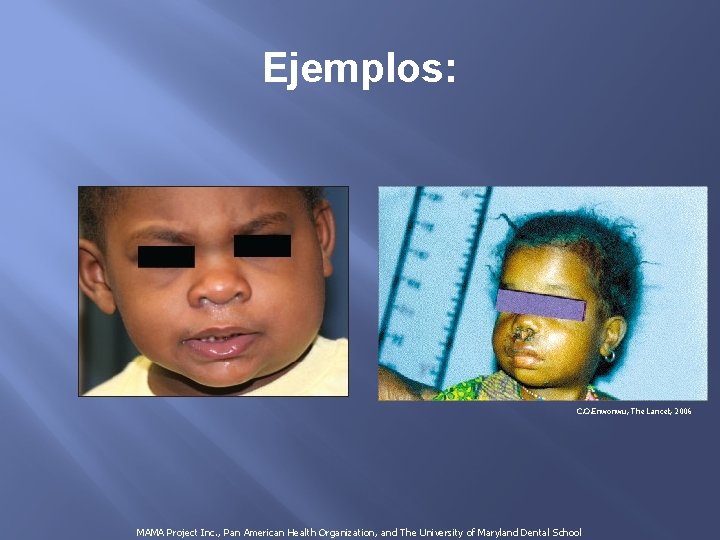 Ejemplos: C. O. Enwonwu, The Lancet, 2006 MAMA Project Inc. , Pan American Health