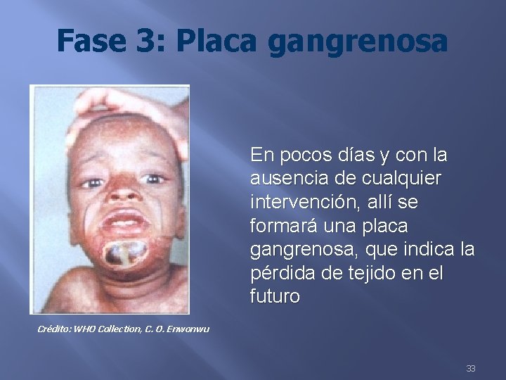 Fase 3: Placa gangrenosa En pocos días y con la ausencia de cualquier intervención,