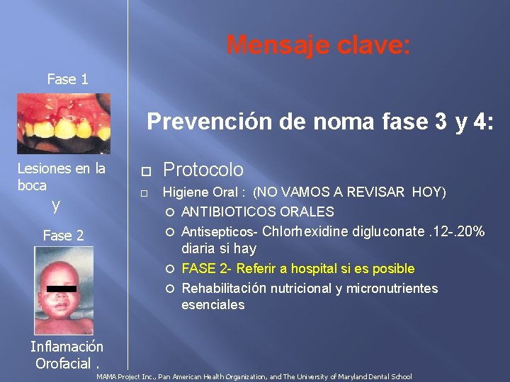 Mensaje clave: Fase 1 Prevención de noma fase 3 y 4: Lesiones en la